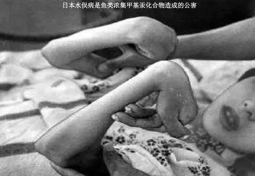 PG电子每年21万吨电子垃圾：养活4万人却让他们活不过25岁(图7)
